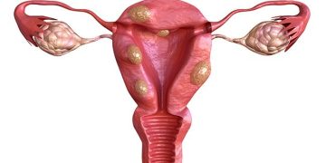 IVF Center In Kompally
