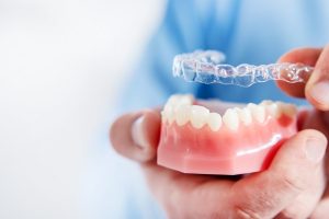 Invisalign cost London