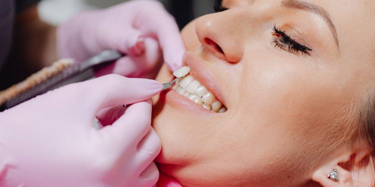 Tips for Eating and Drinking with Porcelain Veneers