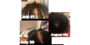 How to Help Damaged Hair with a Scalp Stimulator and These 4 Products