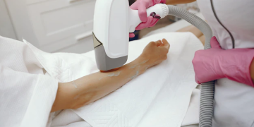 Hair Removal Machine